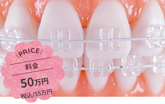 サファイヤブラケット（ラディアンス）