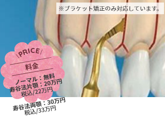 コルチコトミー矯正